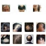 Sérum de Croissance de Cheveux en 7 jours – Image 3