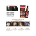 Huile Essentielle de Caféine Anti Chute de Cheveux 30ML – Image 2