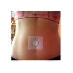 Herbal Slimming Patch – Image 4
