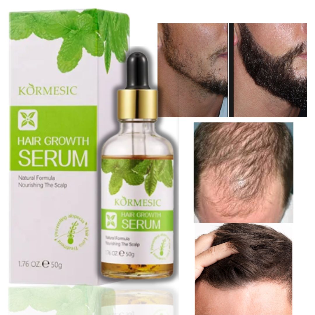 5d128fe6-857d-452b-ae75-ba9711cf5dff KORMESIC – huile d'argan , sérum de croissance des cheveux pour hommes et femmes – Image 1