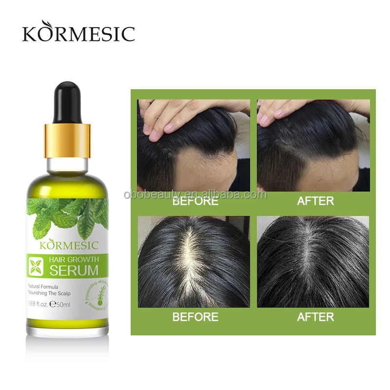 Acd1a8f22eb784a629d4600a3eaf26d7bz KORMESIC – huile d'argan , sérum de croissance des cheveux pour hommes et femmes – Image 1