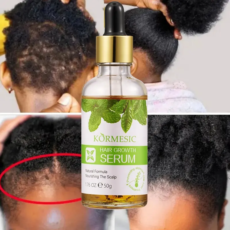 H9b764aa82c2e45029e2047a1bfbe8099v KORMESIC – huile d'argan , sérum de croissance des cheveux pour hommes et femmes – Image 1
